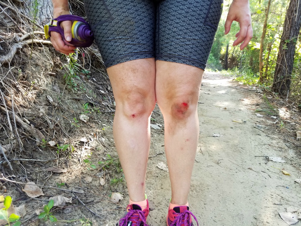 What to expect at your first trail race: you might fall! 