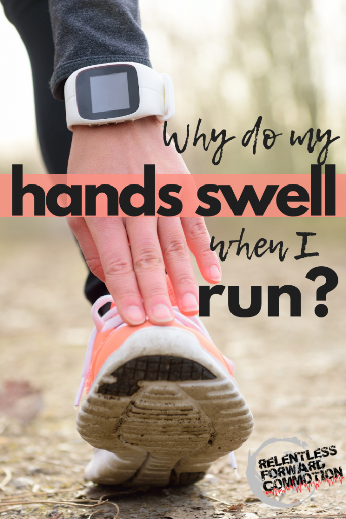 Why Do My Hands Swell When I Run