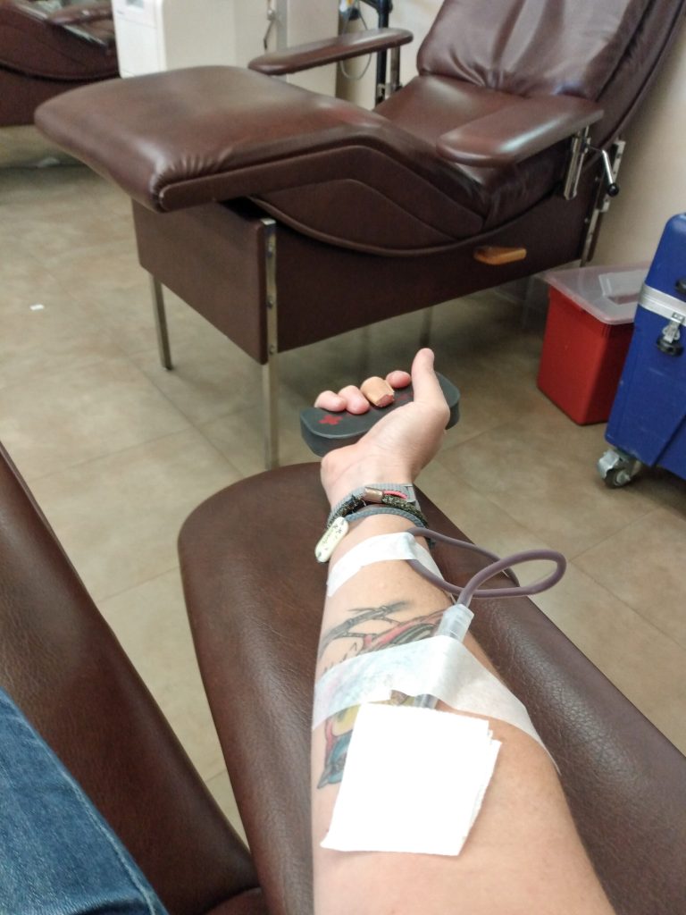 Heather Hart's arm during blood donation 