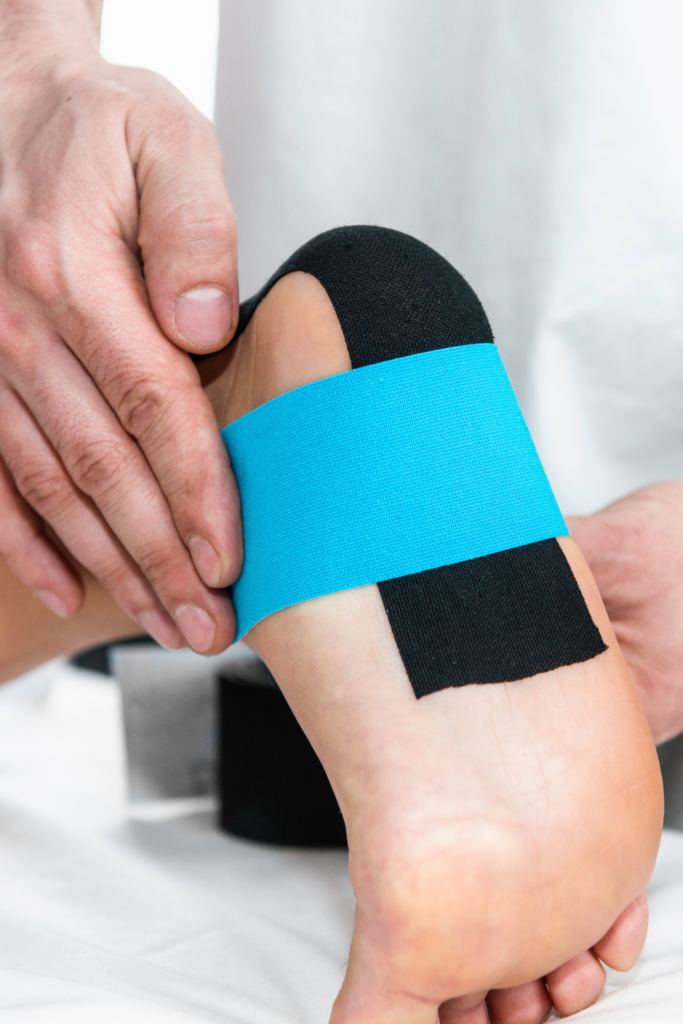 image of a foot covered in kinesiology tape / physio tape to help alleviate plantar fasciitis pain while running